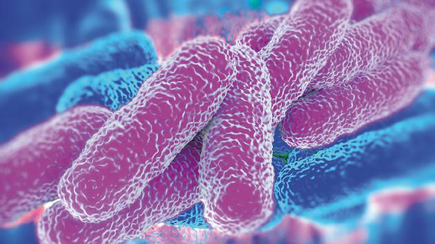 Legionella on the rise